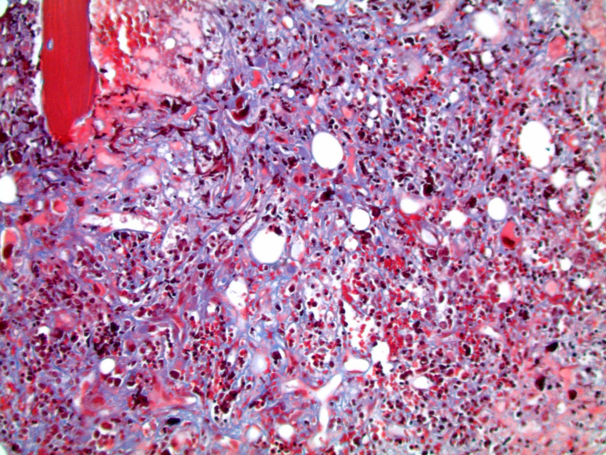 Masson trichrome 200X